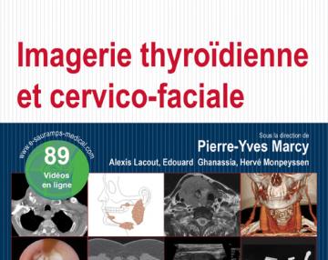 Imagerie thyroïdienne et cervicale