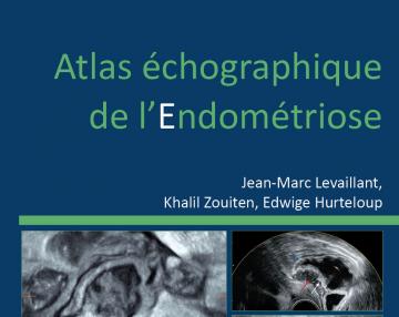 Atlas échographique de l'Endométriose