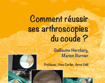 Comment réussir ses arthroscopies du coude ?