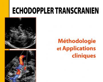 Echodoppler transcrânien - Méthodologie et applications cliniques