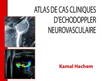 Atlas des cas cliniques d'échodoppler neurovasculaire